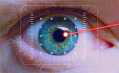 What to expect after LASIK laser eye surgery