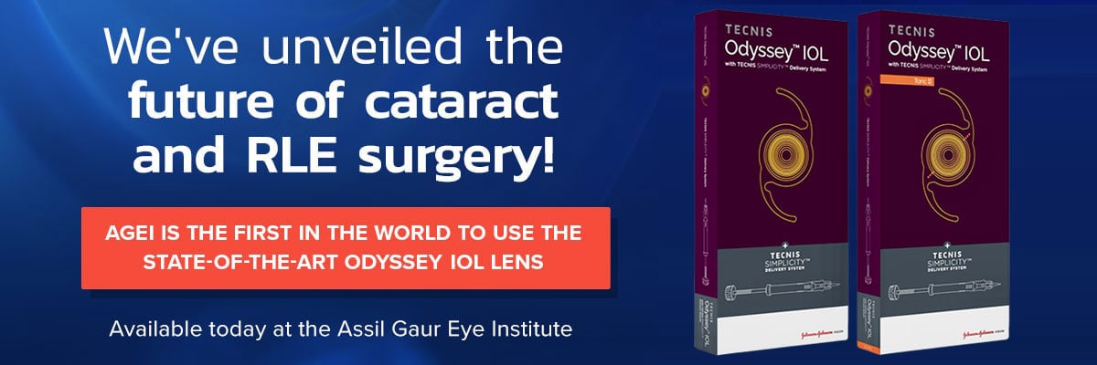 Odyssey Lens for cataract and RLE