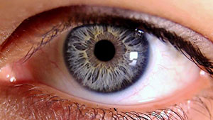 Iris repair, Iris implant surgery, Assil Gaur Eye Institute Beverly Hills