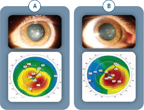 Genetic testing for eye disease, Assil Gaur Eye Institute