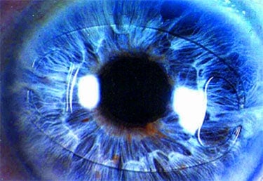 Close-up of a vibrant blue eye with clear details and sharp focus.