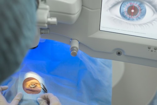 Advanced eye surgery at Assil Gaur Eye Institute in the US.