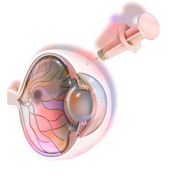 Reverse age-related vision loss
