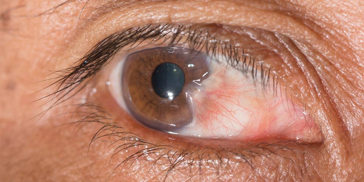 Close-up of an eye with detailed view of iris, eyelid, and eyelash for advanced eye treatment services.