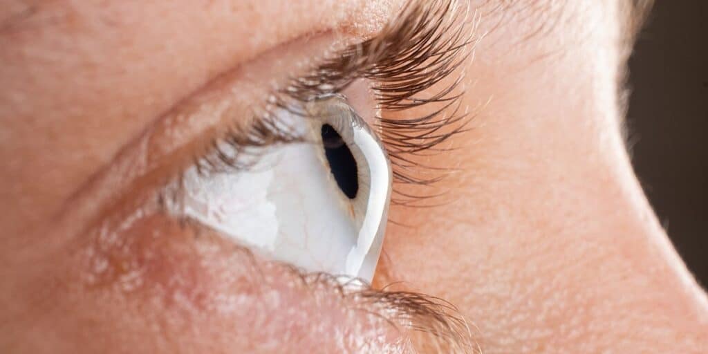 Close-up of an eye undergoing cataract surgery at Assil Gaur Eye Institute, expert eye care provider.