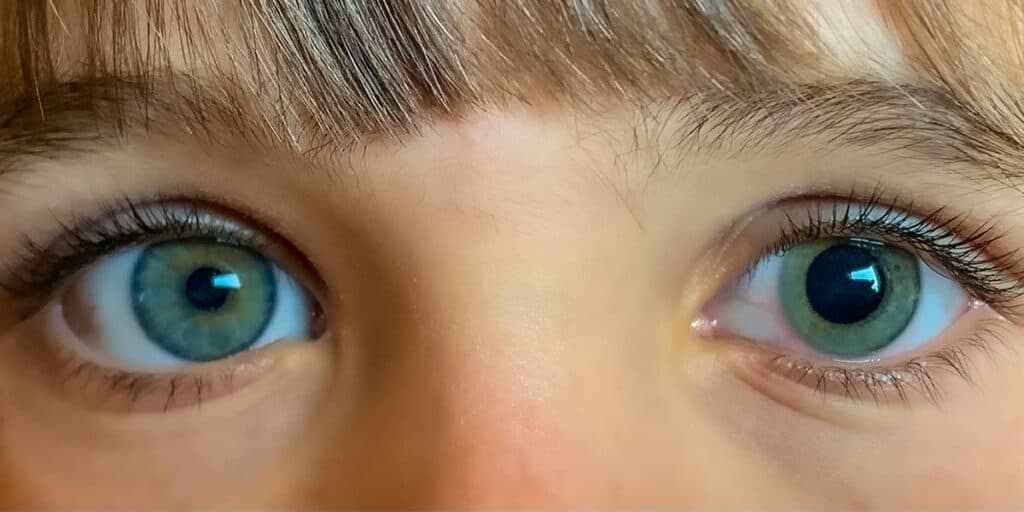 What Does It Mean When Pupils Are Small: Important Information About Pupil Size