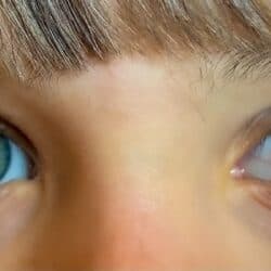 What Does It Mean When Pupils Are Small: Important Information About Pupil Size