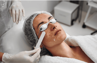 Cosmelan Peel  