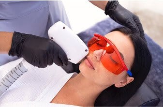 IPL-Photofacial-(DELIT-Plus)