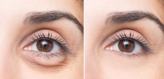 rrevisioinal-eye-surgeryv2