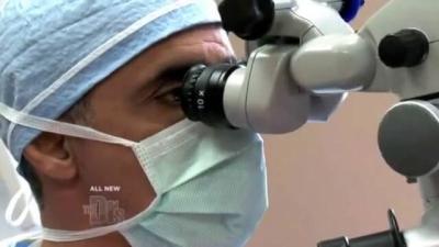 Verisyse or LASIK