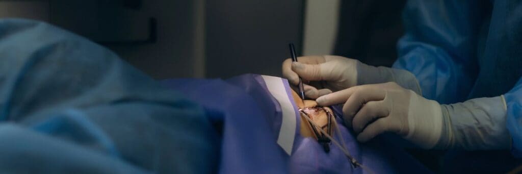 A surgical team performing eye surgery at Assil Gaur Eye Institute.