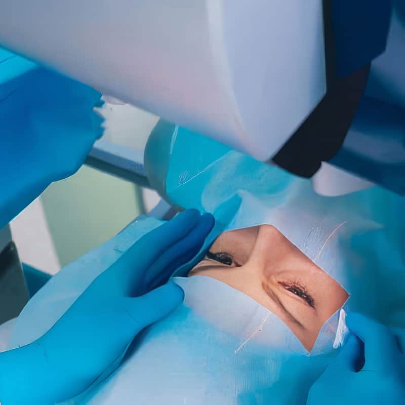 Surgeon performing eye surgery with patient under medical equipment.