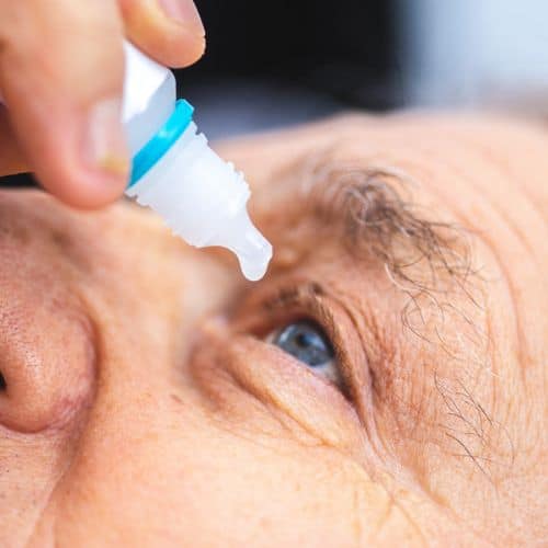Eye drop being applied to an elderly person's eye for eye health treatment.
