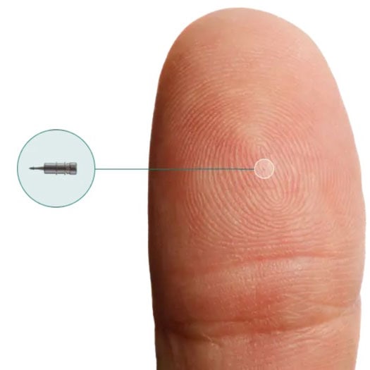 Close-up of a finger with a tiny injection device for glaucoma treatment.